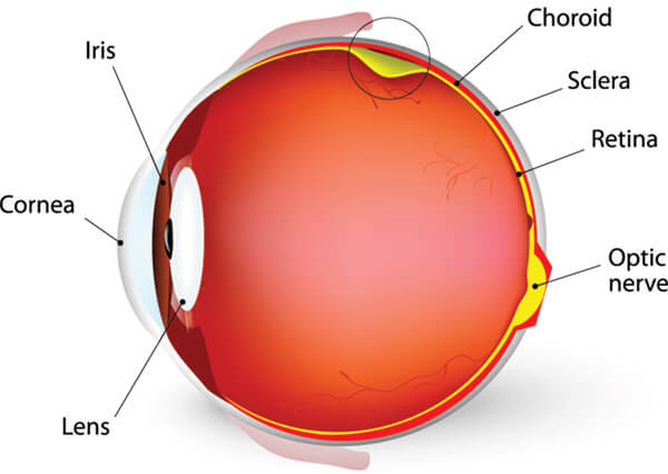 Retina Detachment Chart